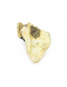 Condrosarcoma de la... 2
