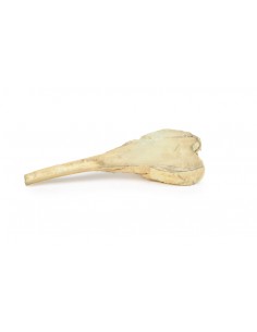 Osteosarcoma del fémur -...