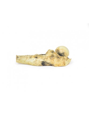 Osteosarcoma del fémur - Erler Zimmer... Osteosarcoma del fémur - Erler Zimmer...