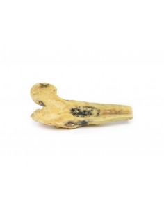 Osteosarcoma del fémur -... 2