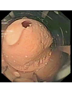 Simulador de gastroscopia...