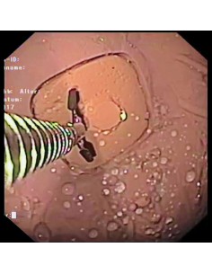 Simulador de gastroscopia... 2