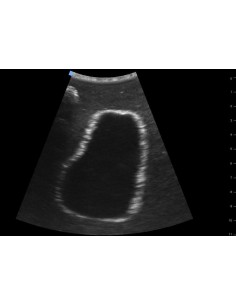 ENTRENADOR DE ULTRASONIDOS...