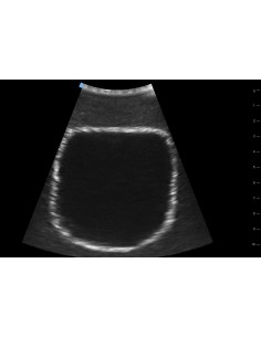 ENTRENADOR DE ULTRASONIDOS... 2