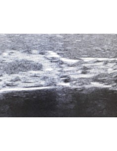 Entrenador de ultrasonidos... 2