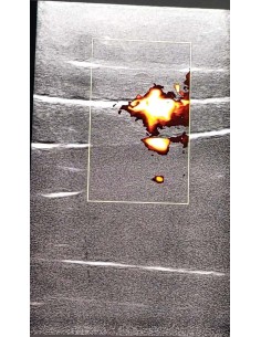 Simulador de inyección en... 2