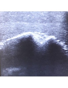 Simulador de ultrasonidos...