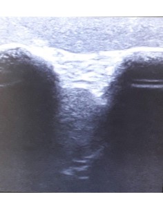 Simulador de ultrasonidos... 2