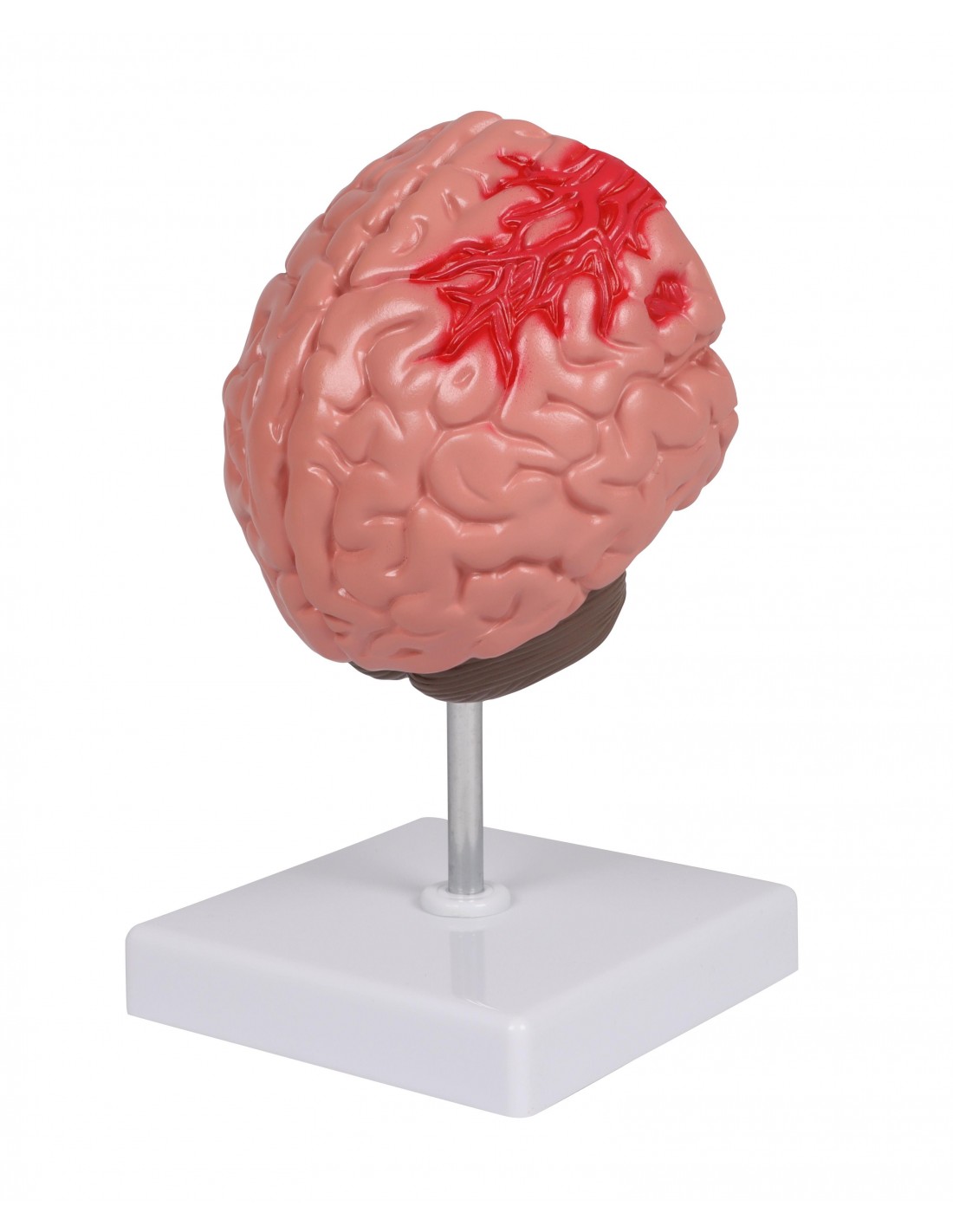 Patologías del cerebro humano Erler... Patologías del cerebro humano Erler...