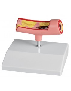 Erler Zimmer, modelo...