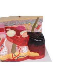 Modelo patológico de piel...