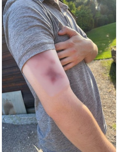 Moulage e simulazione di ferita...