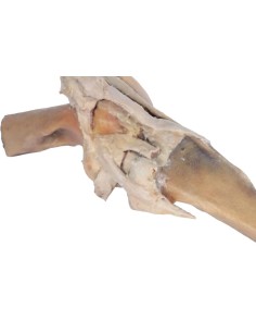 Articulación de rodilla de... 2