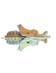 Disección de la pelvis del...