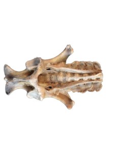 Disección de la pelvis del... 2
