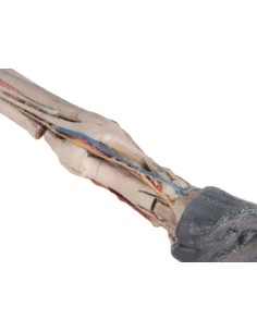 Tendones, ligamentos, vasos... 2