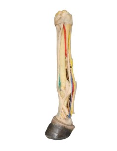 Disección palmar profunda... 2