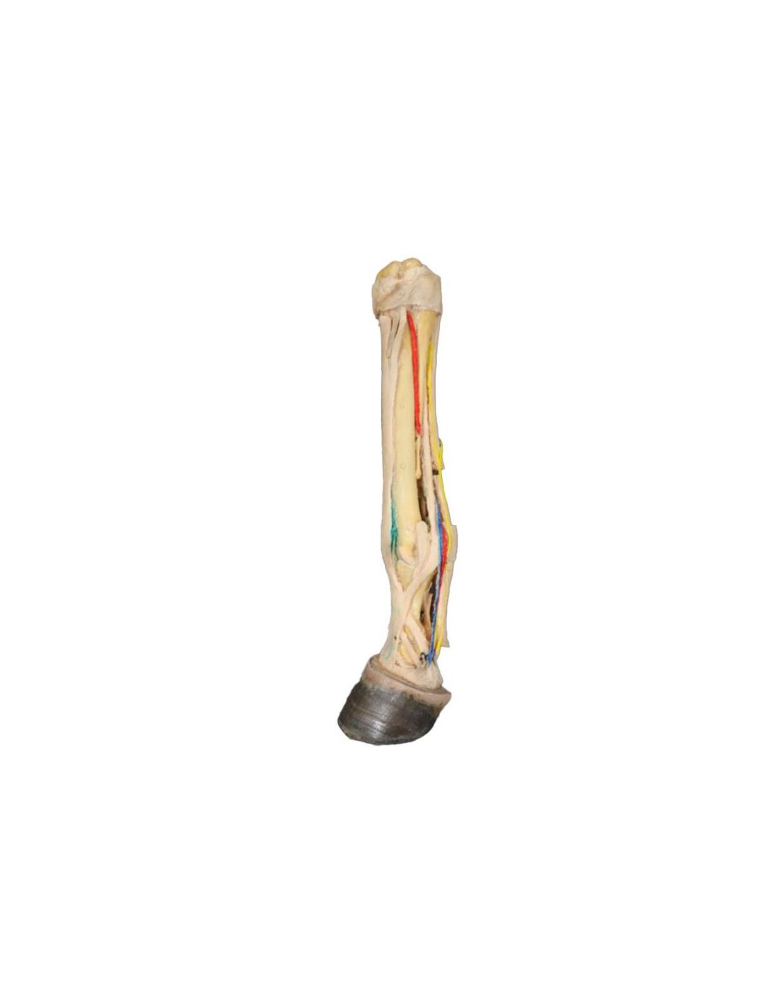 Disección palmar profunda del pie de... Disección palmar profunda del pie de...