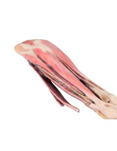 Miembro anterior del... 2