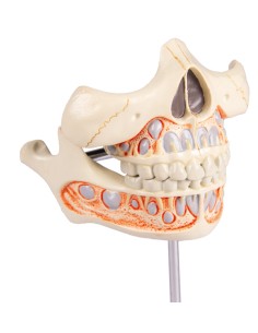 Maqueta de dentición de...